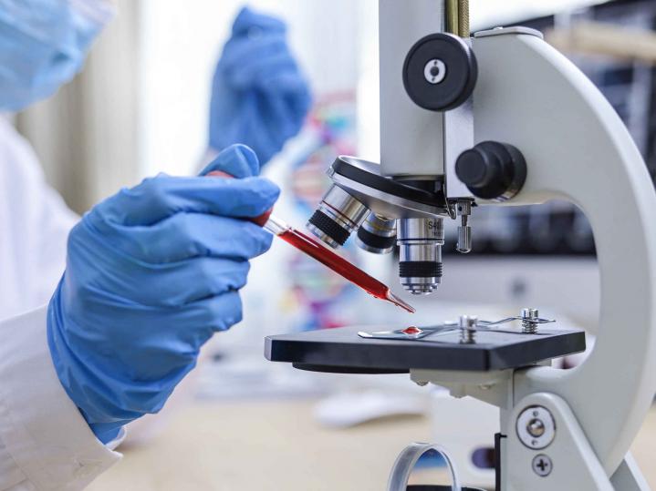 Ein Laborant hält eine Pipette mit roter Flüssigkeit in der Hand und gibt es auf ein Untersuchungsglas des Mikroskops.