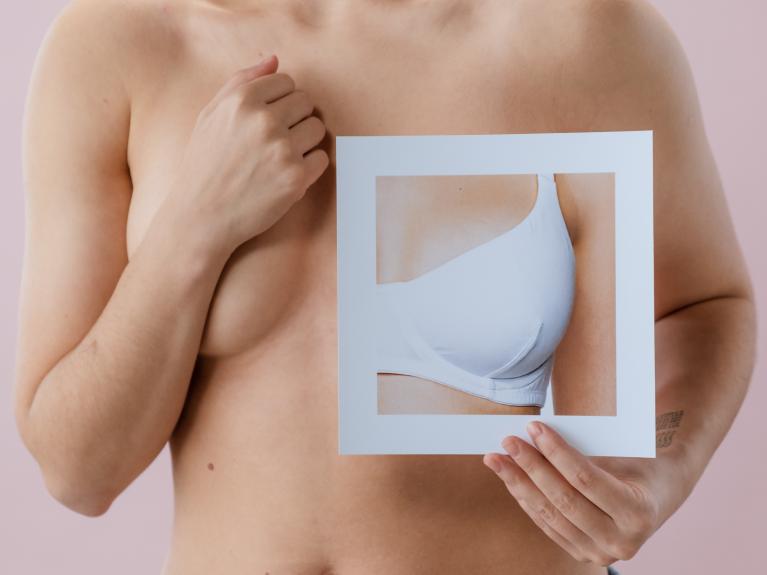 Frau hält Brustbild vor fehlende Brust