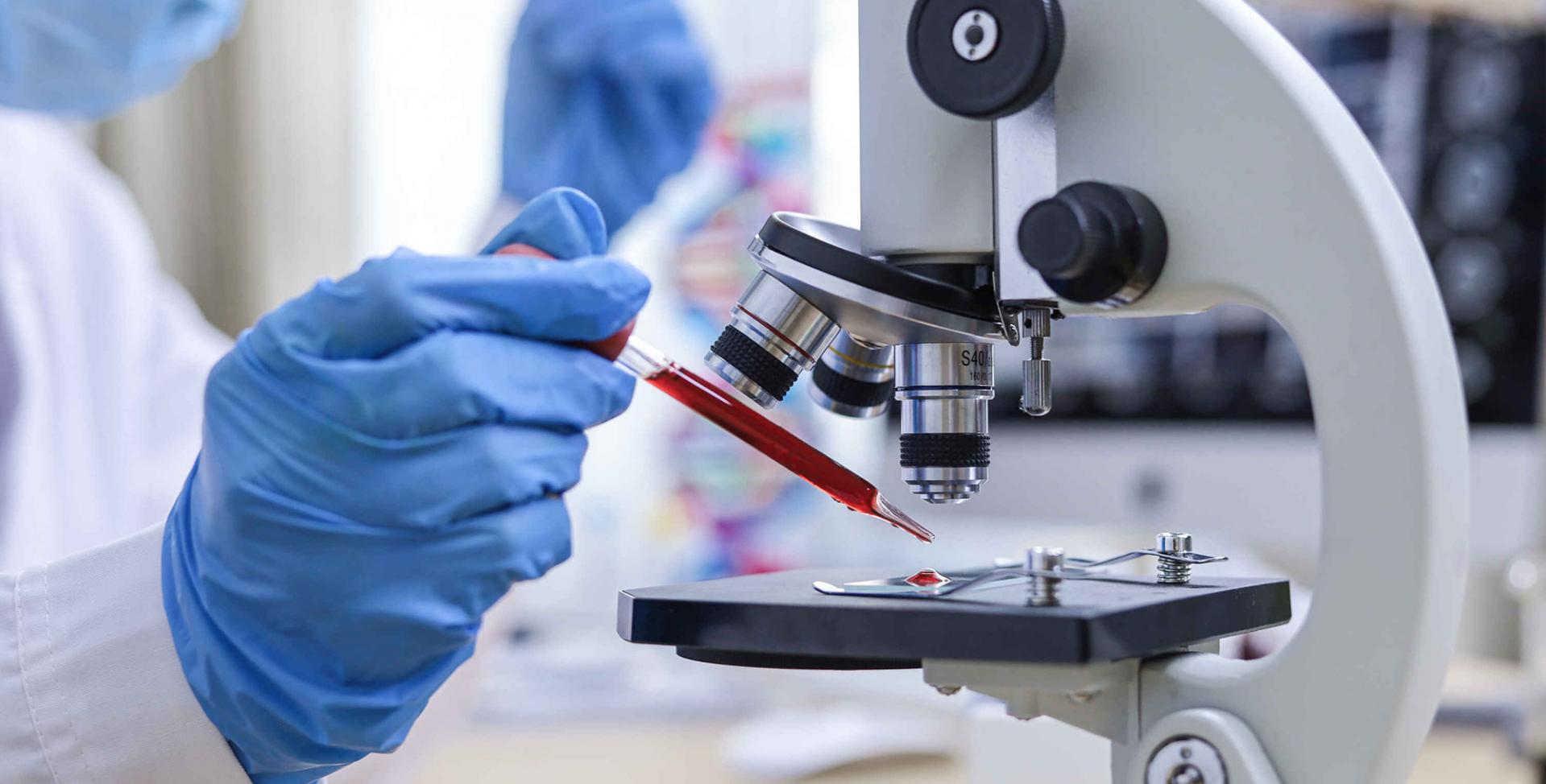 Ein Laborant hält eine Pipette mit roter Flüssigkeit in der Hand und gibt es auf ein Untersuchungsglas des Mikroskops.